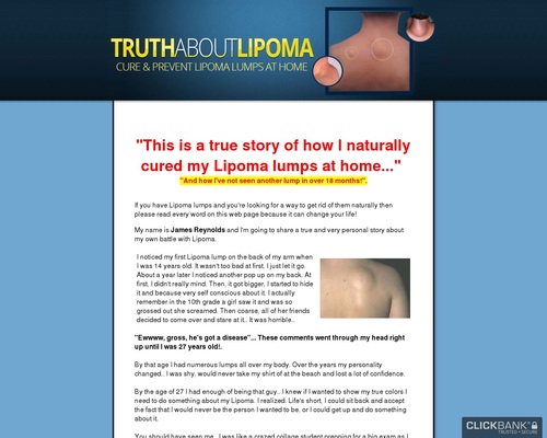 Truth About Lipoma By James Reynolds Good To Seo - bad mesh names popup broken studio bugs roblox
