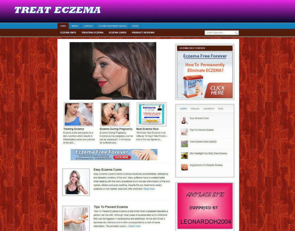 TREAT ECZEMA ADVICE STORE & WEBSITE WITH AFFILIATES - FREE DOMAIN PRO DESIGN