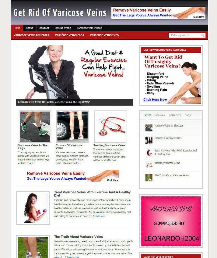 VARICOSE VEINS ADVICE BLOG /WEBSITE WITH MULTI AFFILIATES AND NEW DOMAIN